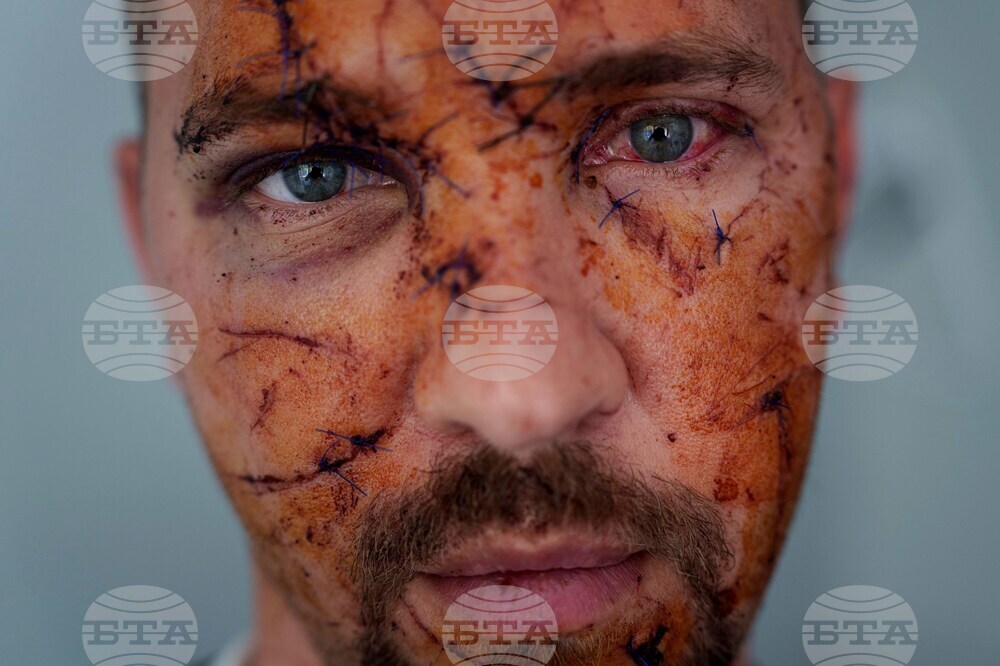 Russia Ukraine War Anniversary