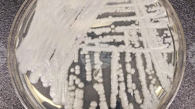 Нов тест показва антибиотиците, които ефективно действат срещу определени бактерии