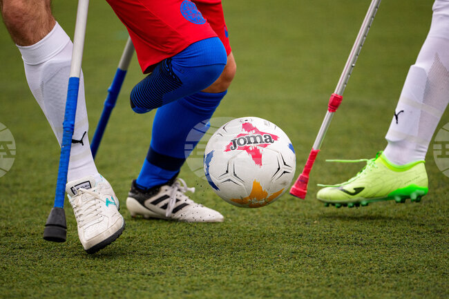 APTOPIX Romania Amputee Soccer