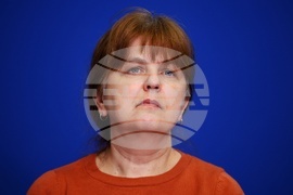 Национален пресклуб на БТА София - Коалиция HPV - пресконференция