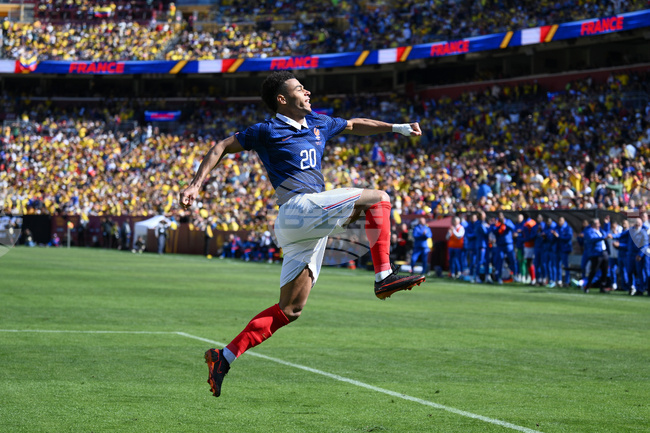 APTOPIX Colombia France Soccer