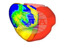 Digital Twin Hearts