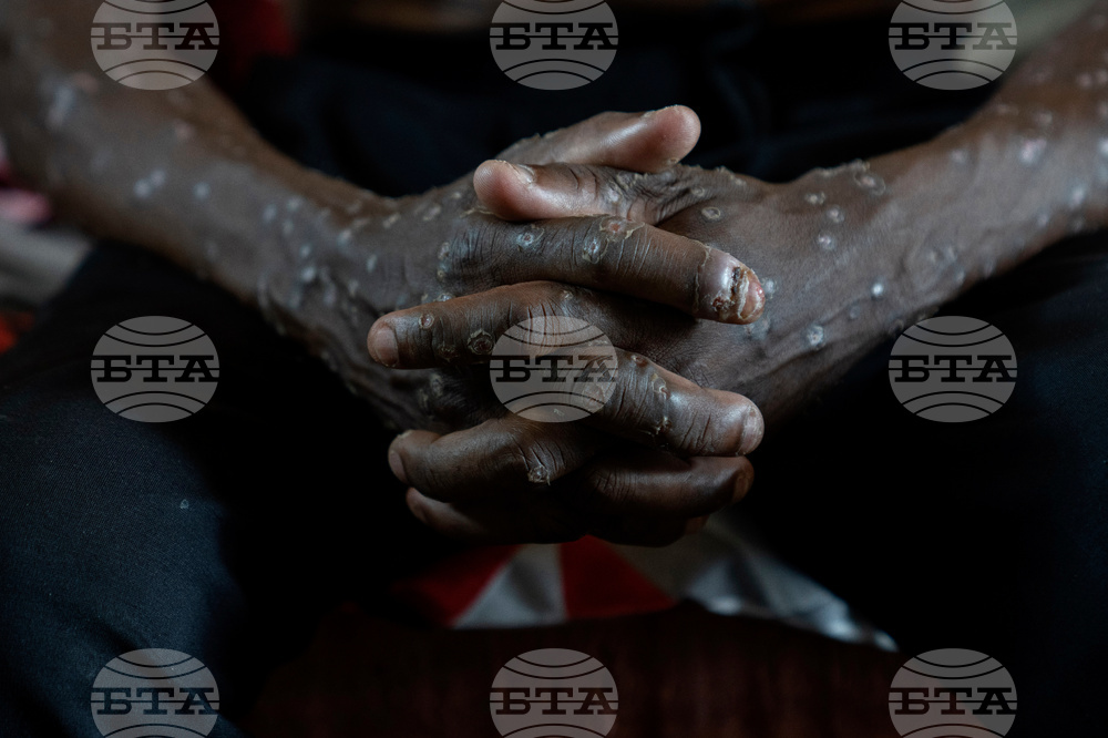 Congo-Mpox Outbreak