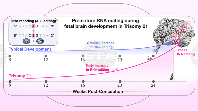 Учени от САЩ и МУ-София с ключово за различното развитие на мозъка при синдром на Даун