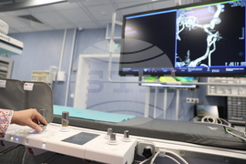 УМБАЛ „Св. Анна“ - Център за лечение на мозъчно-съдови заболявания - откриване