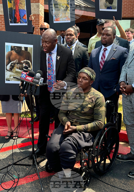 Georgia Jail Amputation