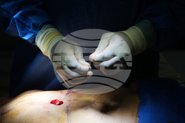 Cosmetic Interventions Ethics