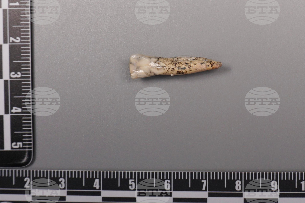 Ancient Human Teeth