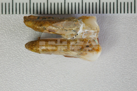 Ancient Human Teeth