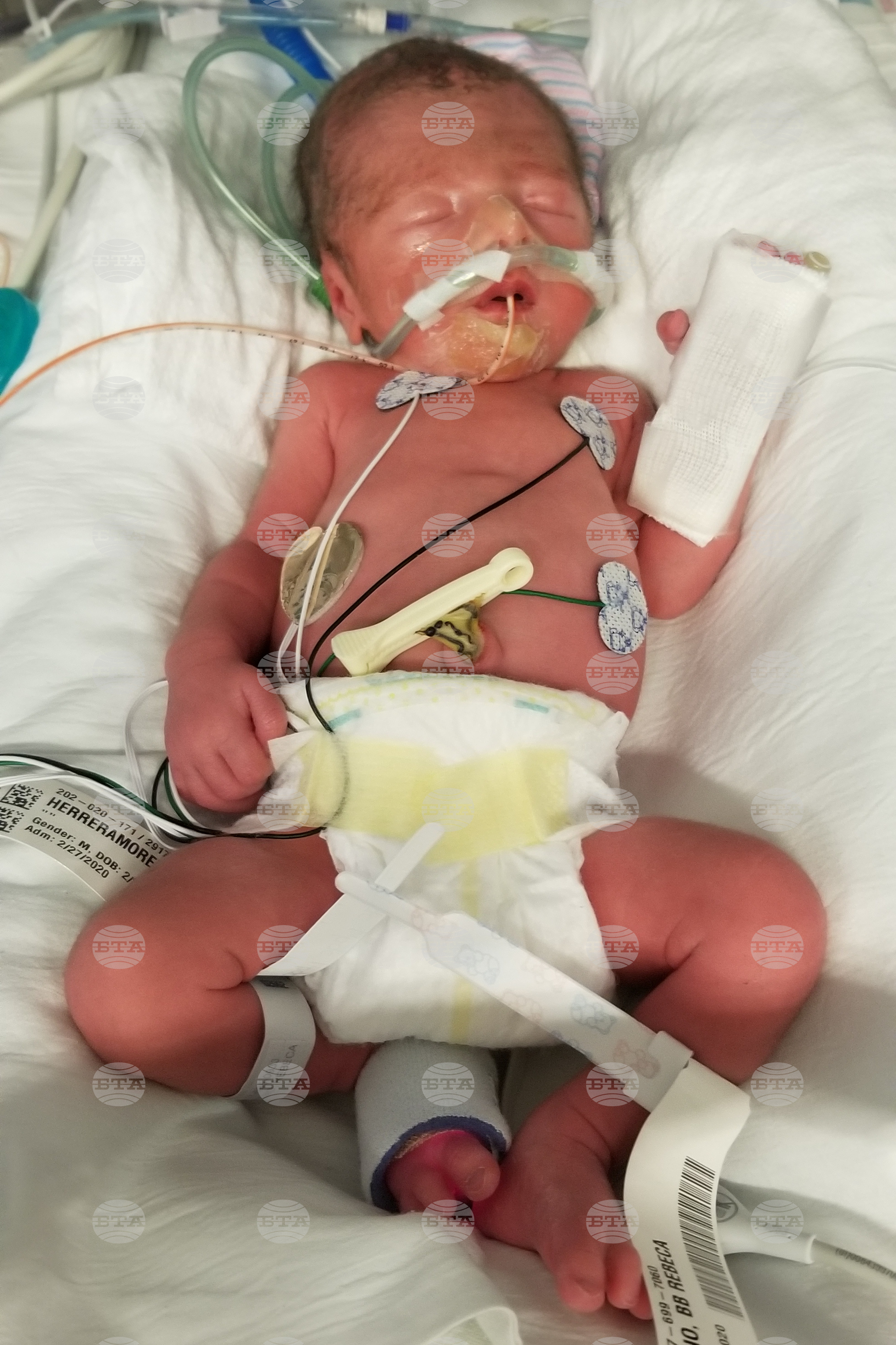 Neonatal Leave