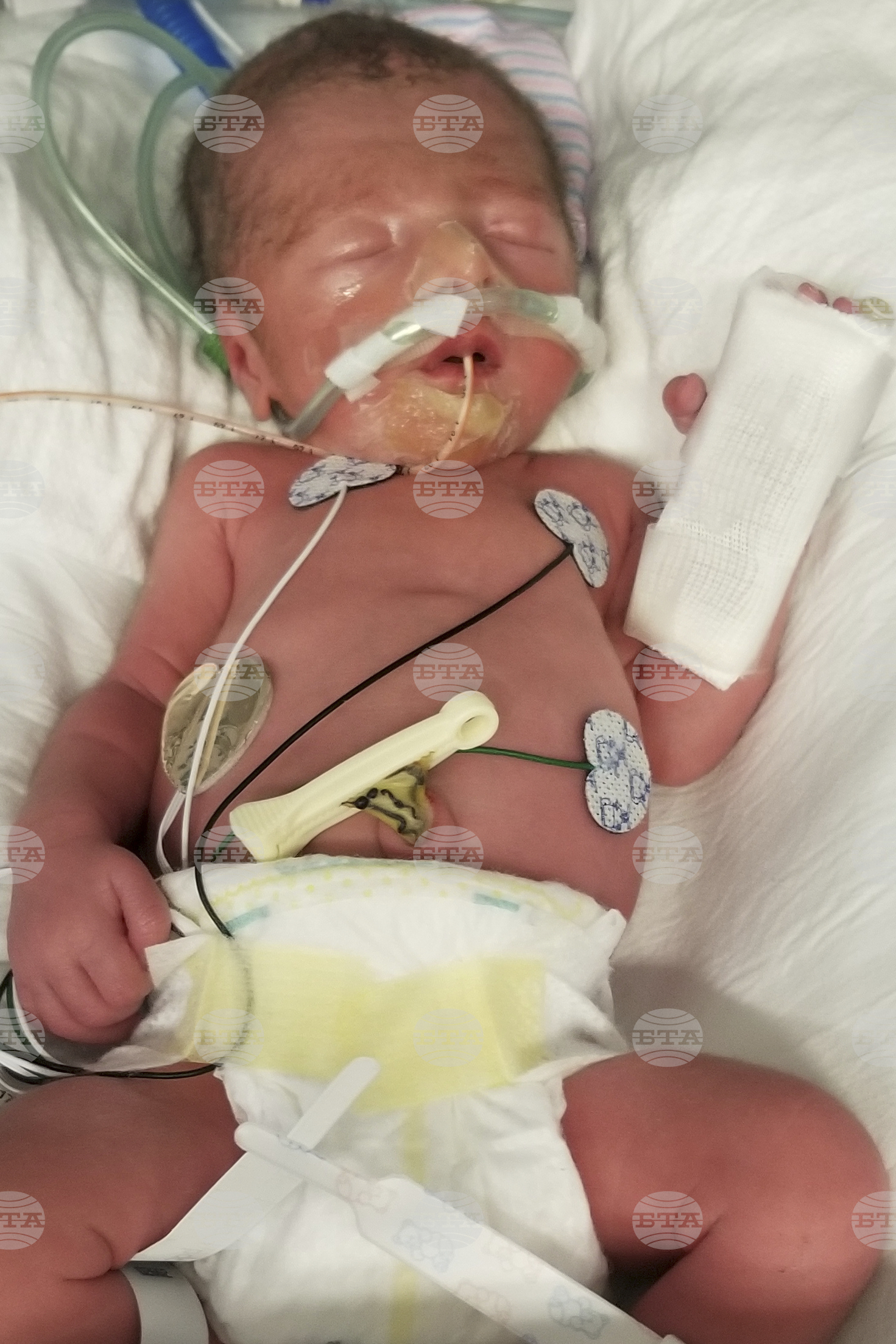Neonatal Leave