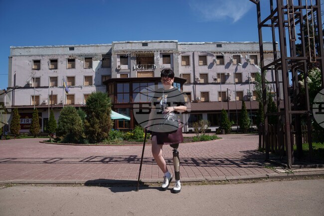 Russia Ukraine War Amputee Rebuilds