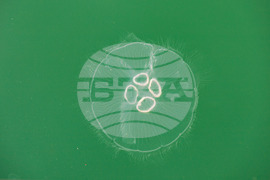 Бургас - Черно море - медузи