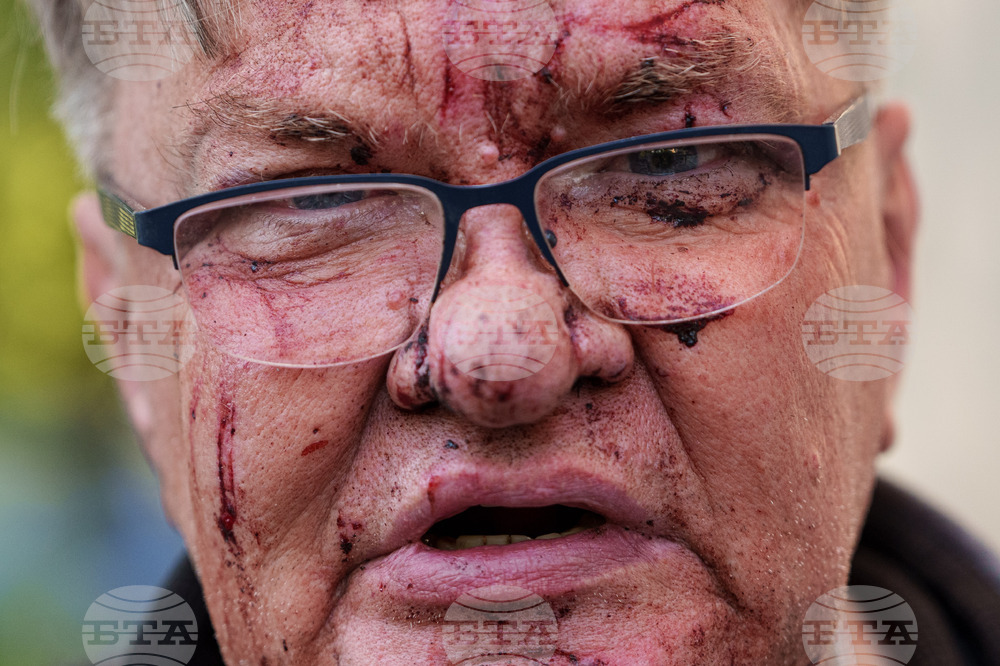 Russia Ukraine War