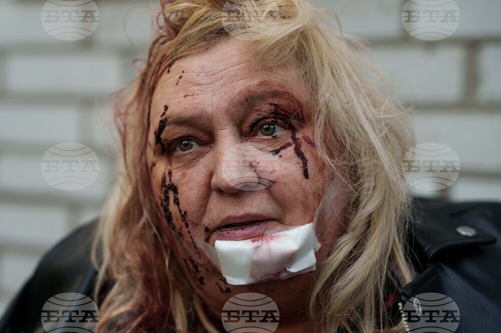 Russia Ukraine War