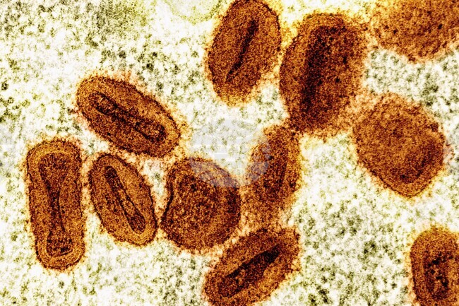Scientists Charged Mpox