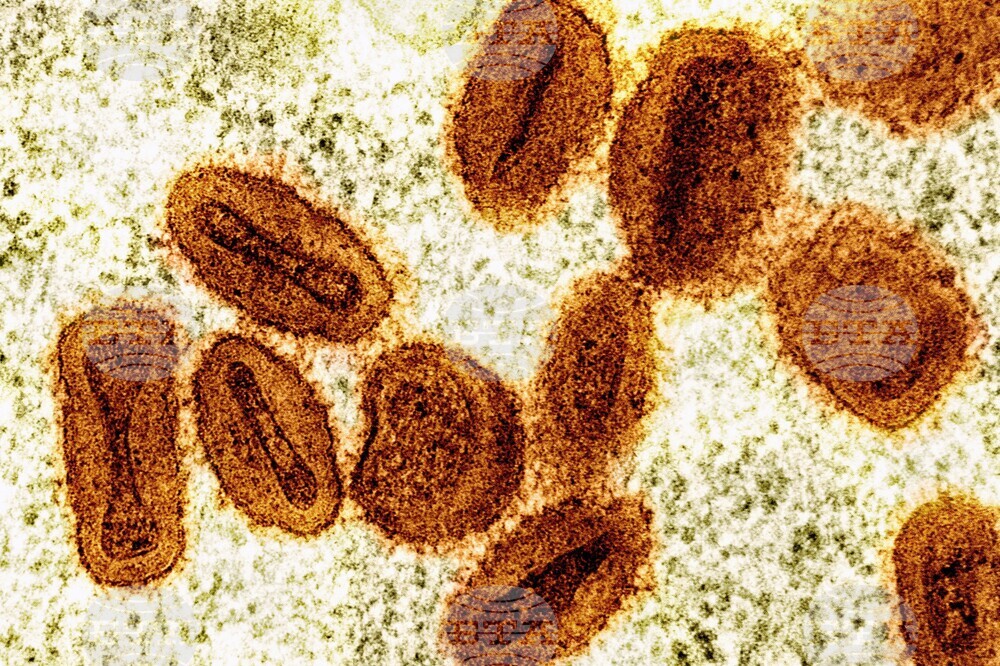 Scientists Charged Mpox