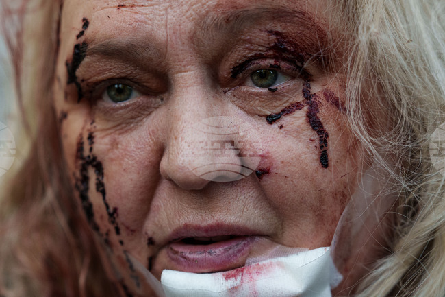 APTOPIX Russia Ukraine War