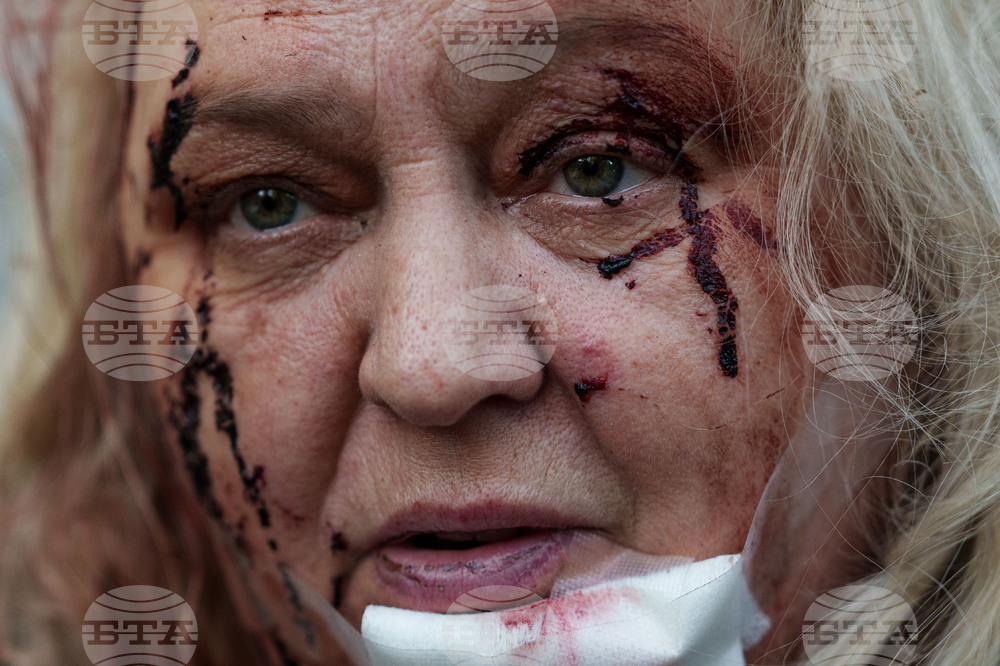 APTOPIX Russia Ukraine War