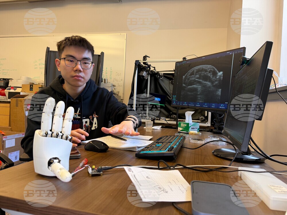 AI Robot Hands Wristband