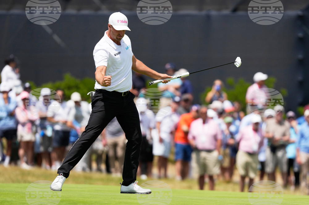 APTOPIX US Open Golf