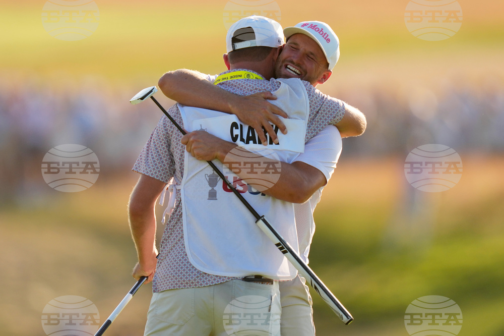 APTOPIX US Open Golf