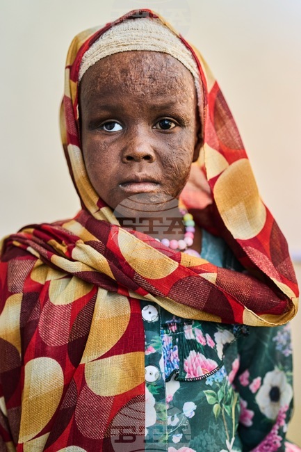 Sudan Scars Of War