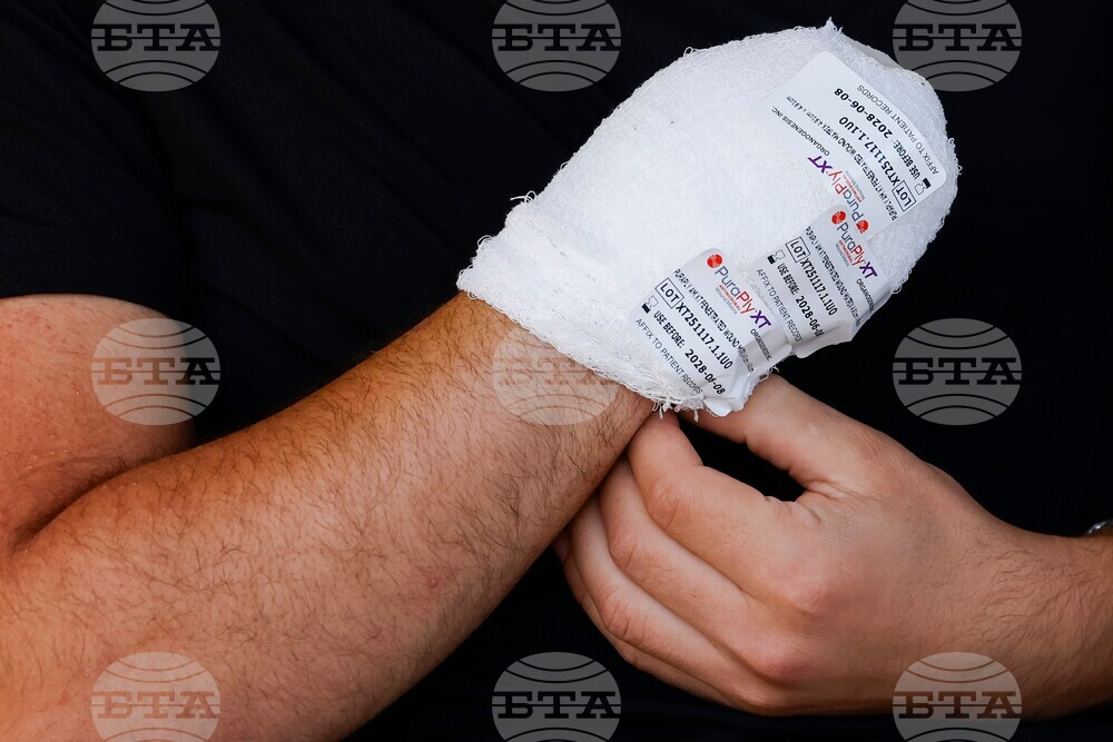 California Firework Injury