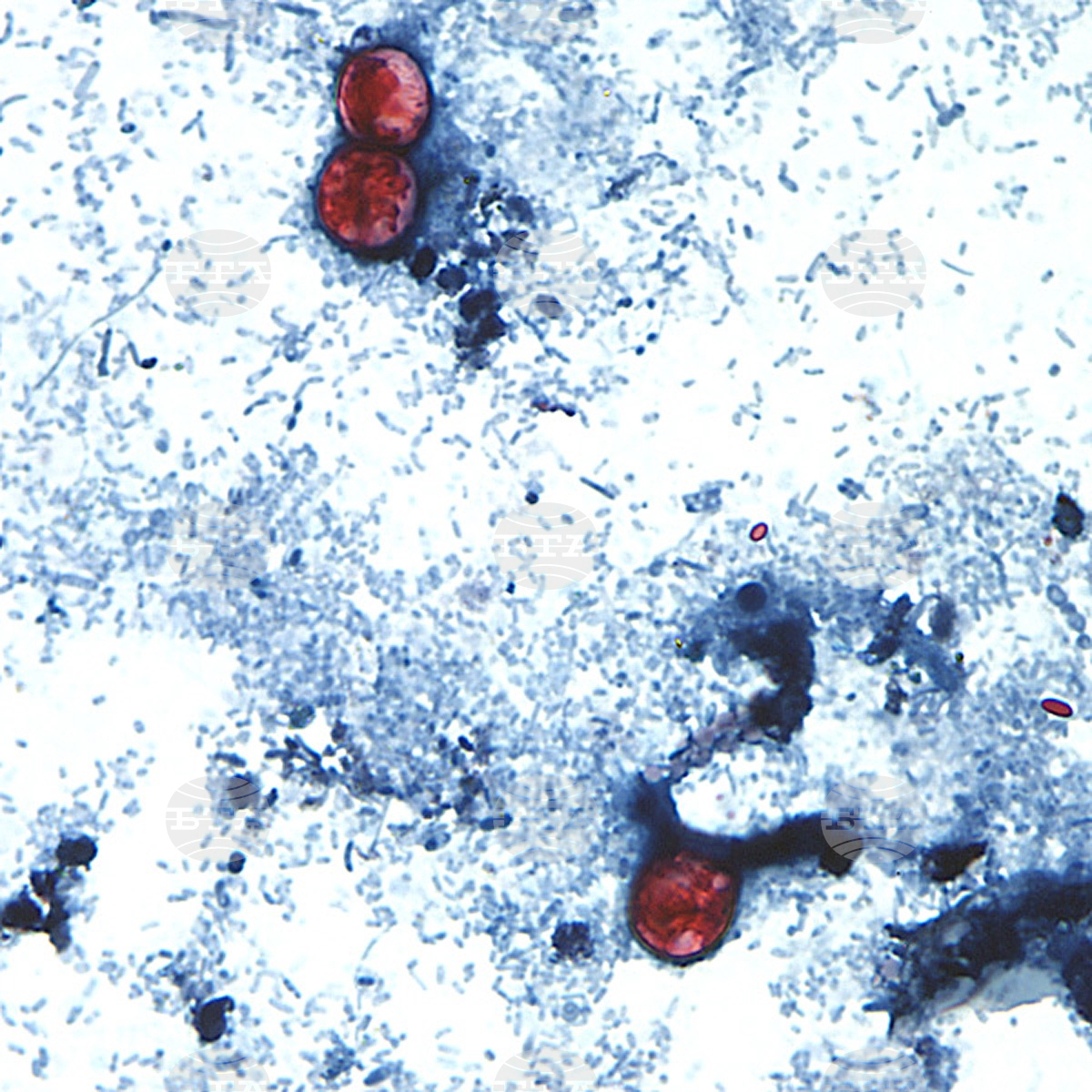 Cyclospora Outbreak