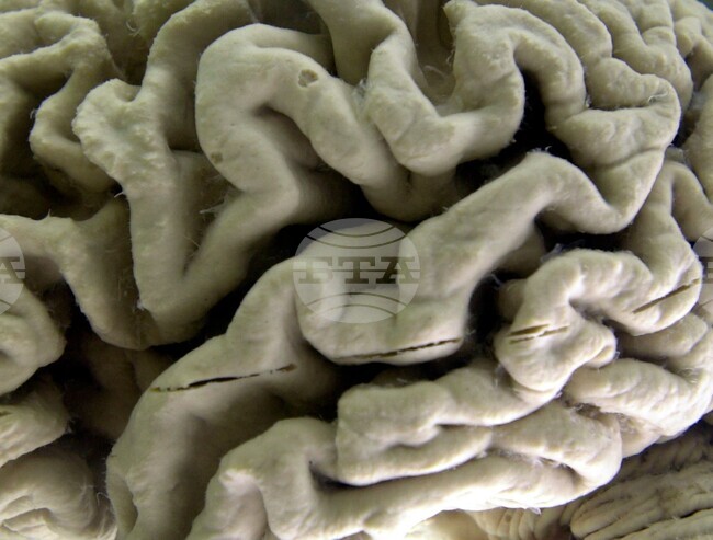 Alzheimers-Blood Test