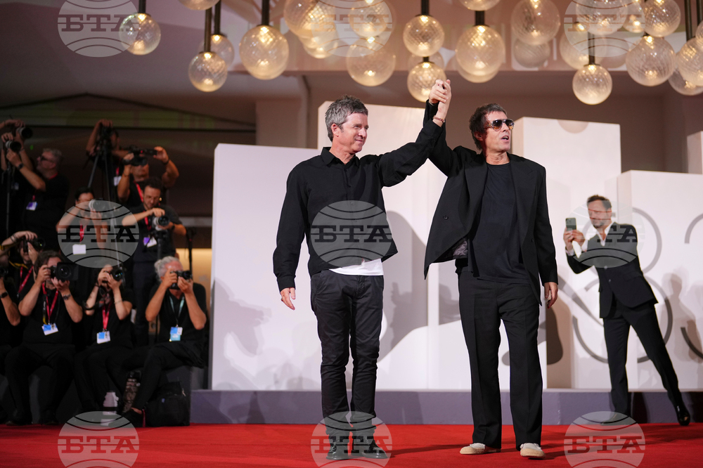 APTOPIX Italy Venice Film Festival Oasis: Don't Look Back In Anger Red Carpet