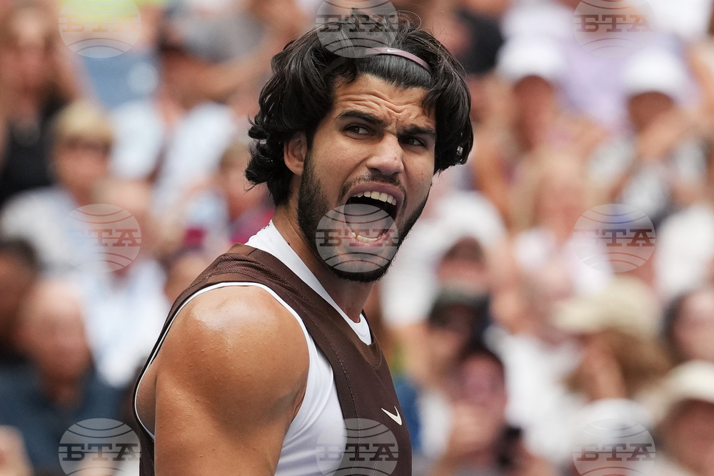 APTOPIX US Open Tennis