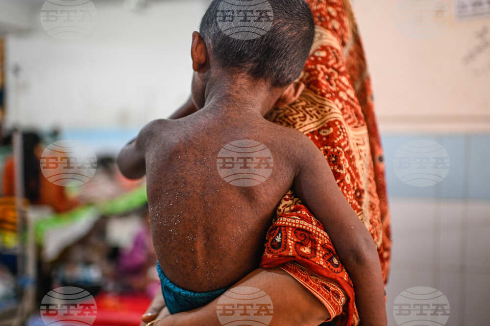 Bangladesh Measles Outbreak