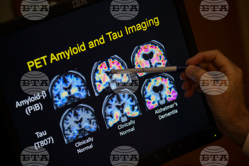 Be Well-Alzheimer's-Blood Tests