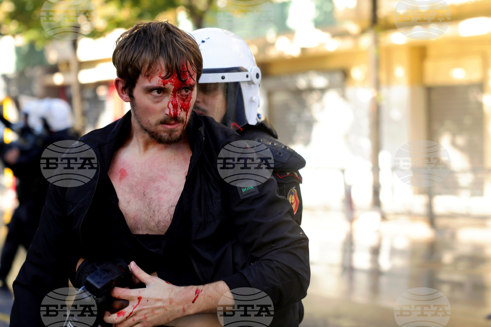 APTOPIX Albania Protest