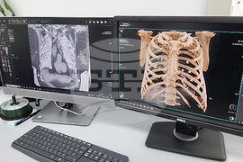 Кърджали - МБАЛ „Д-р Ат. Дафовски“ - медицинска апаратура