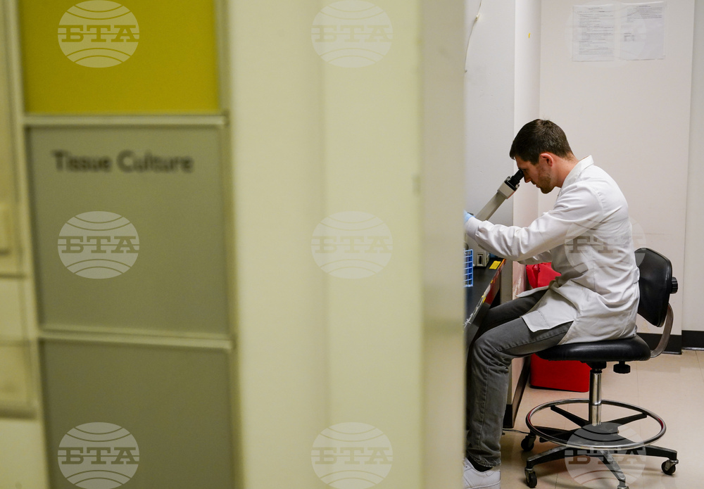 Учените установиха ролята на естрогена за по-силната коремна болка при жените