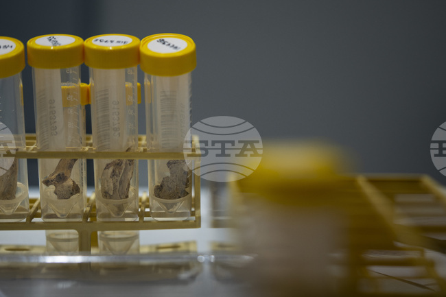 Китайски изследователи откриха как генетичен дефект играе ключова роля при развиването на лупус