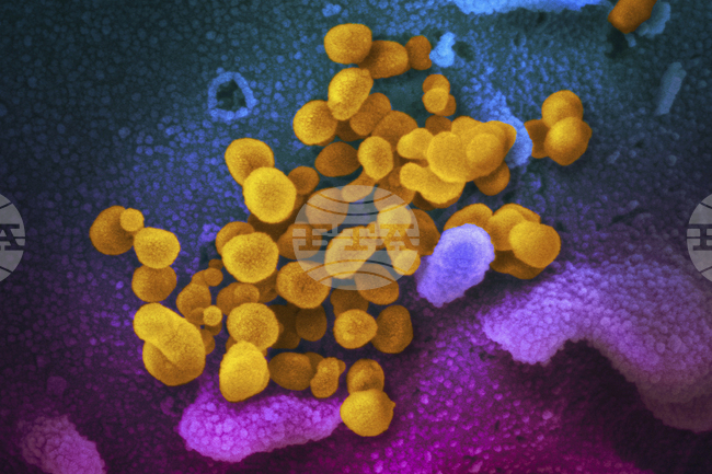 В САЩ се е появил нов вариант на КОВИД-19