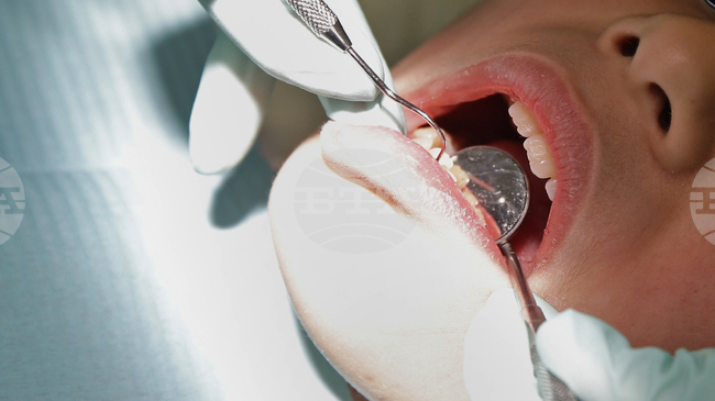 Експерти посочват хранителните продукти, които най-силно оцветяват зъбния емайл