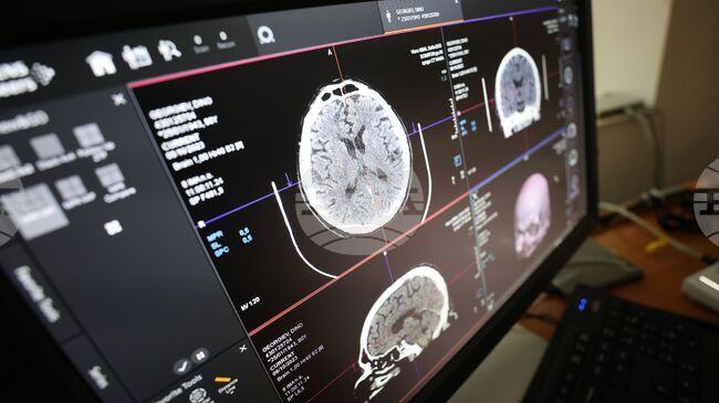 Cardiovascular Disease Is Leading Cause of Death in Bulgarians in 2025
