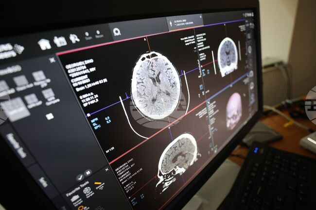 Cardiovascular Disease Is Leading Cause of Death in Bulgaria in 2025