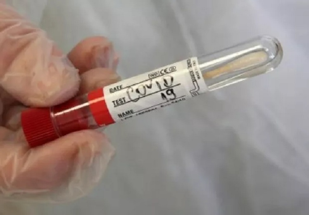 COVID-19 Update: 186 New Cases, Test Positivity Rate at 5.1%
