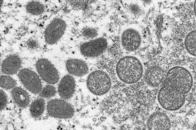 Във Великобритания предлагат ваксиниране срещу маймунска шарка на мъже, които са гейове или бисексуални