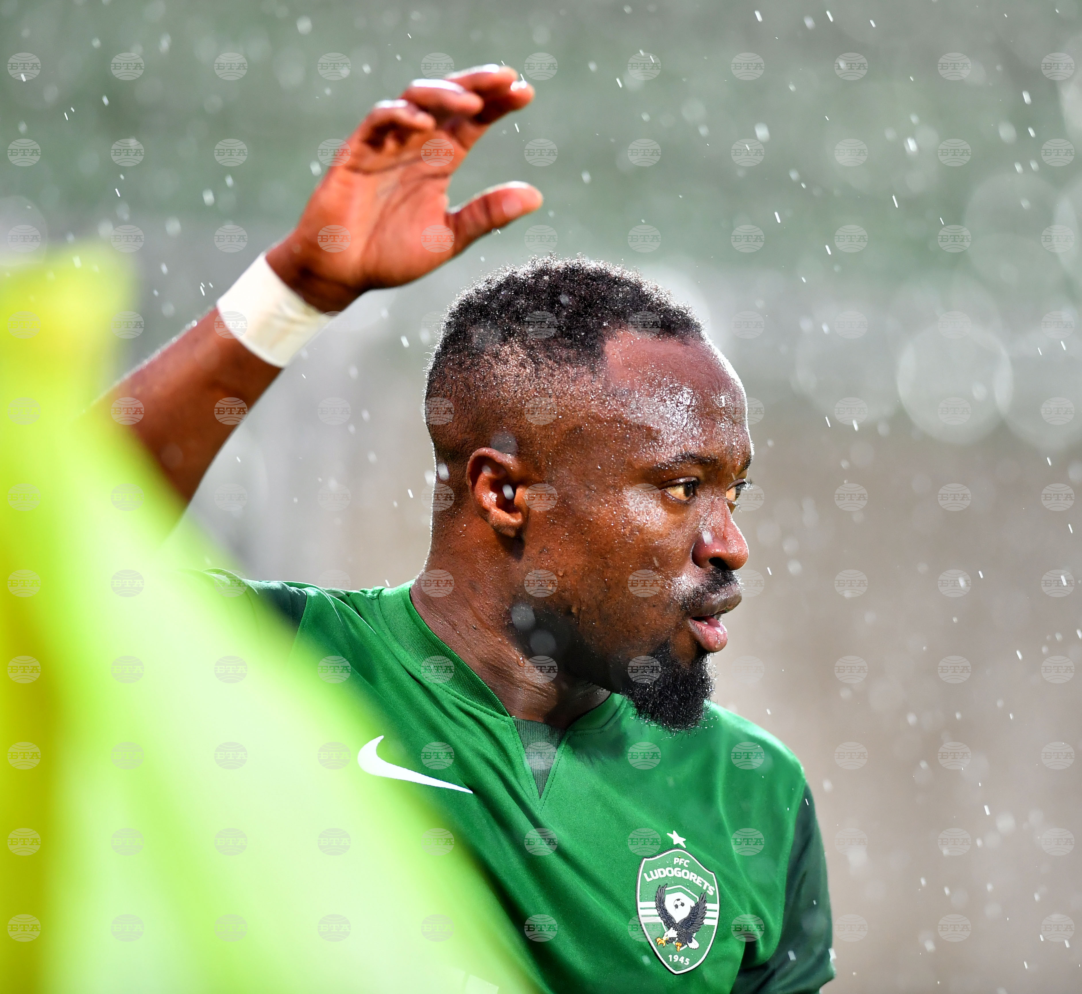 Бернард Текпетей претърпя успешна операция на скулата