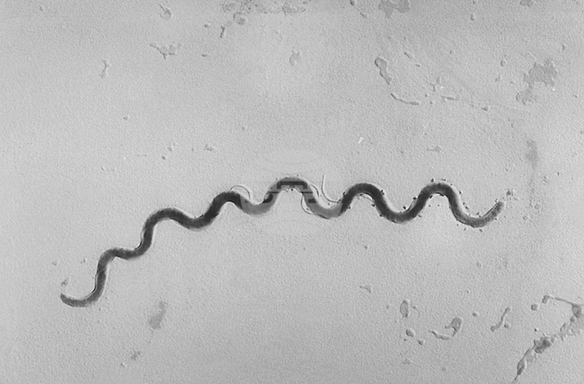 Случаите на сифилис са достигнали рекордни нива в Германия през 2024 г.