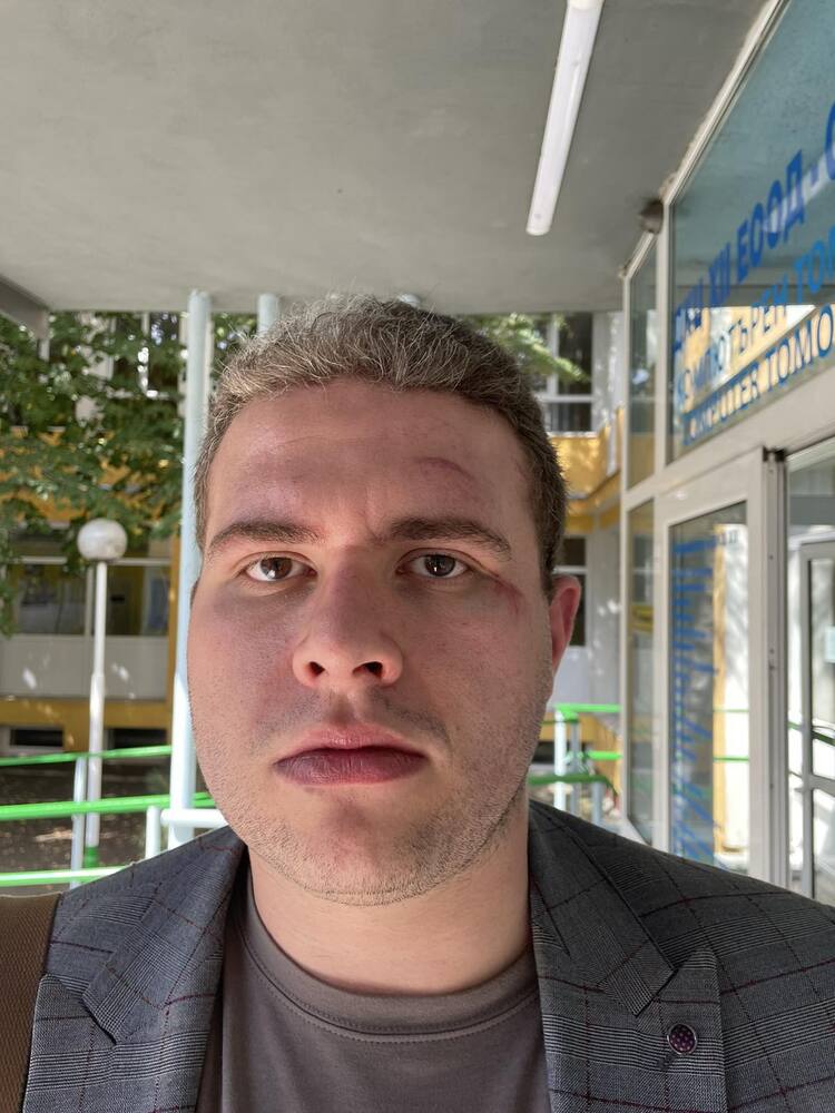 Побой над кандидат за народен представител от БСП в късните часове на Девети септември