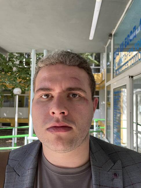 Побой над кандидат за народен представител от БСП в късните часове на Девети септември