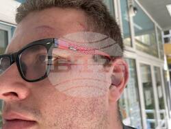 Кандидатът за народен представител от листата на "БСП за България" в 23-ти МИР в София Никола Попстоев беше нападнат и бит в късните часове на Девети септември. 