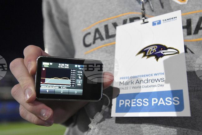 Учени разработиха преносимо устройство за контролиране на диабета в реално време